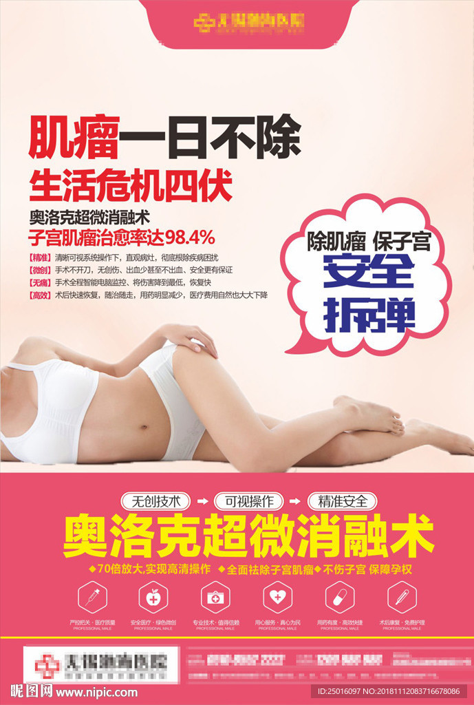 子宮肌瘤