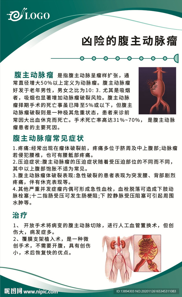 主動脈瘤