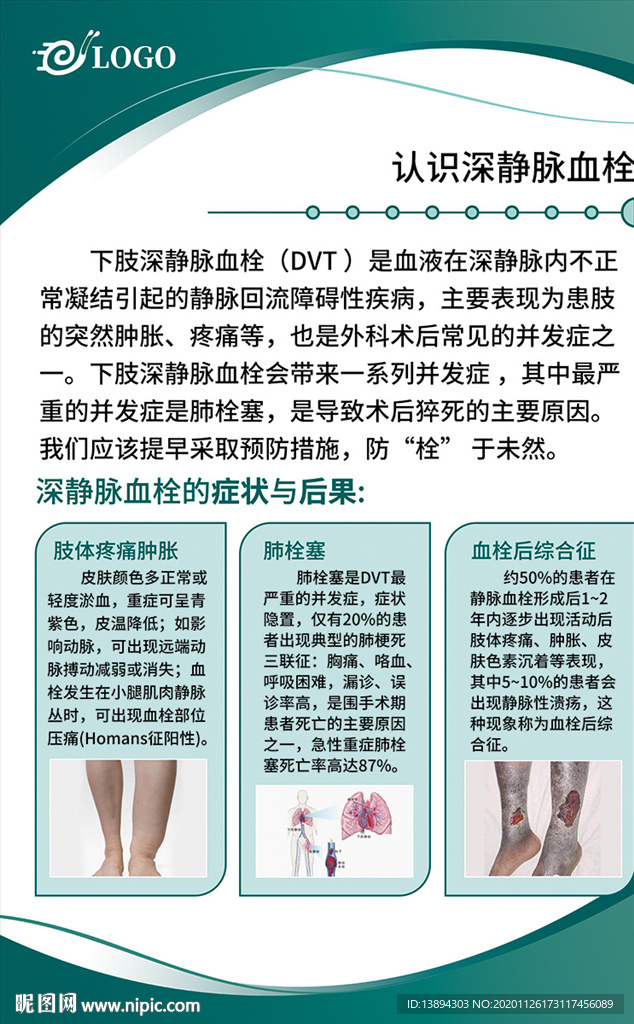 認識深靜脈血栓