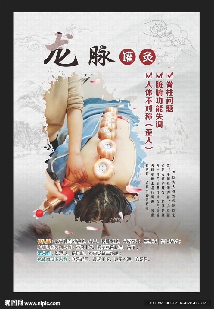 龍脈罐灸海報(bào)