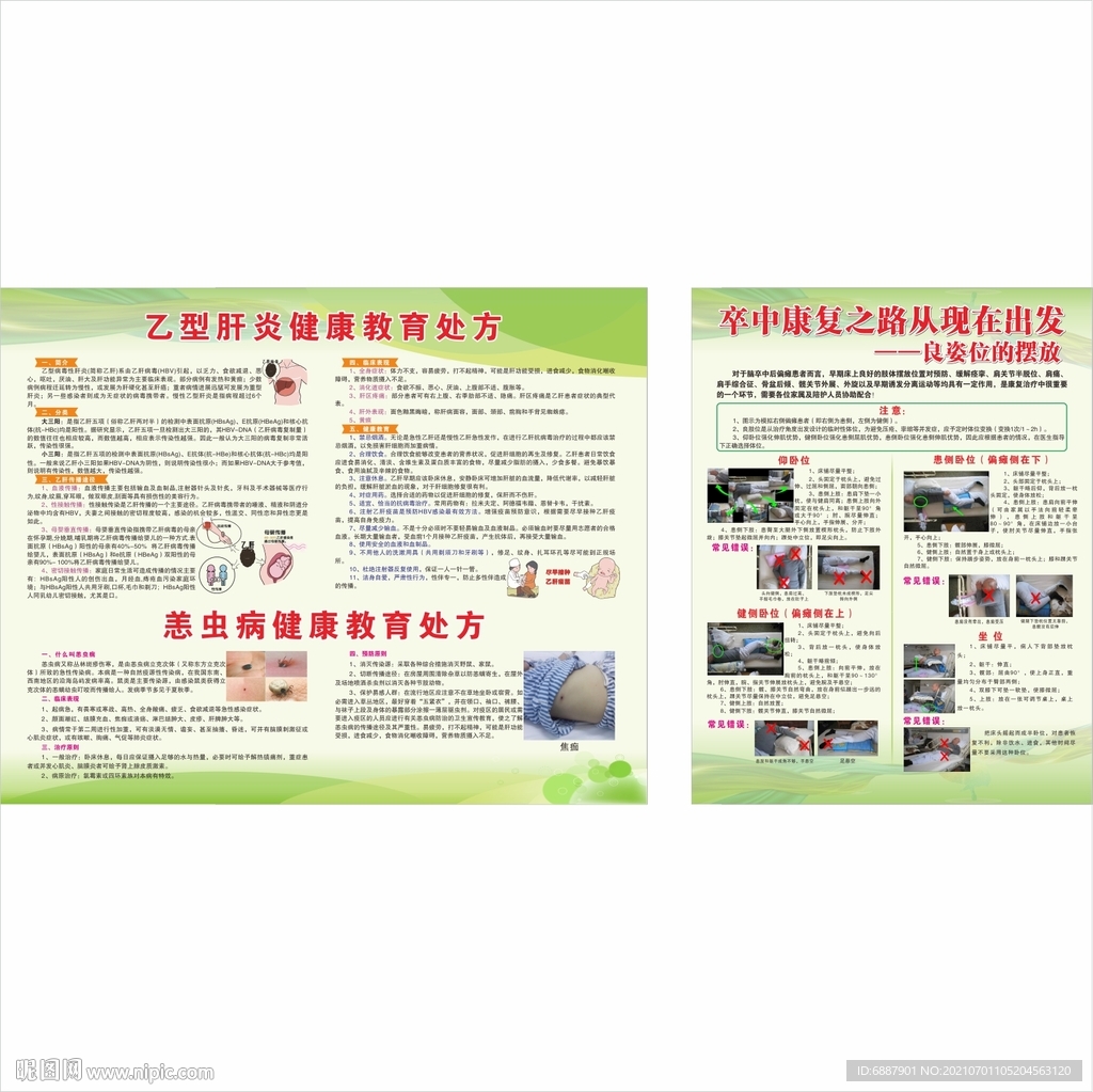 乙型肝炎  卒中康復(fù)