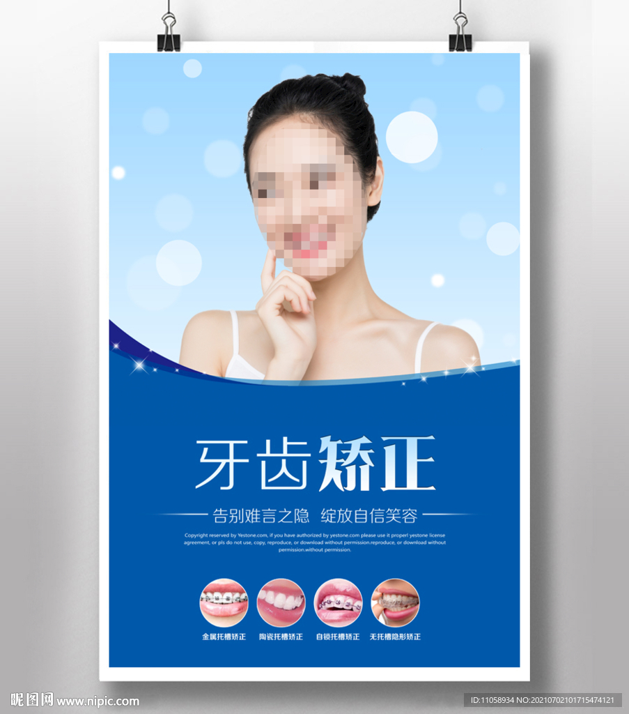 牙齒矯正