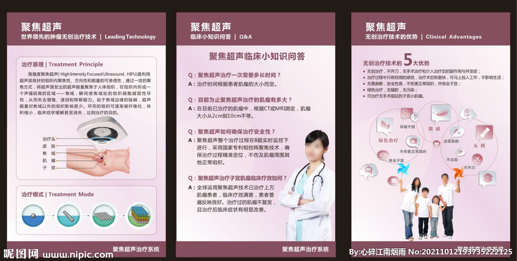 聚焦超聲