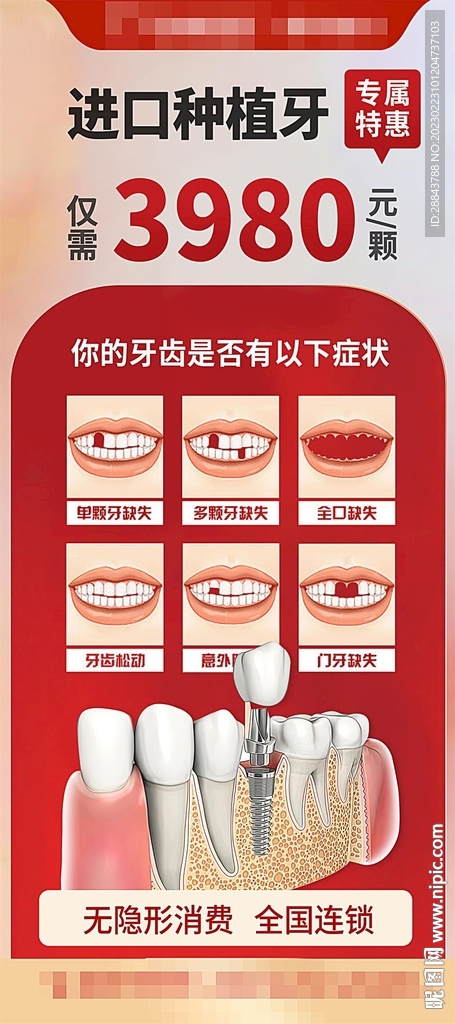 红色种植牙活动海报展架