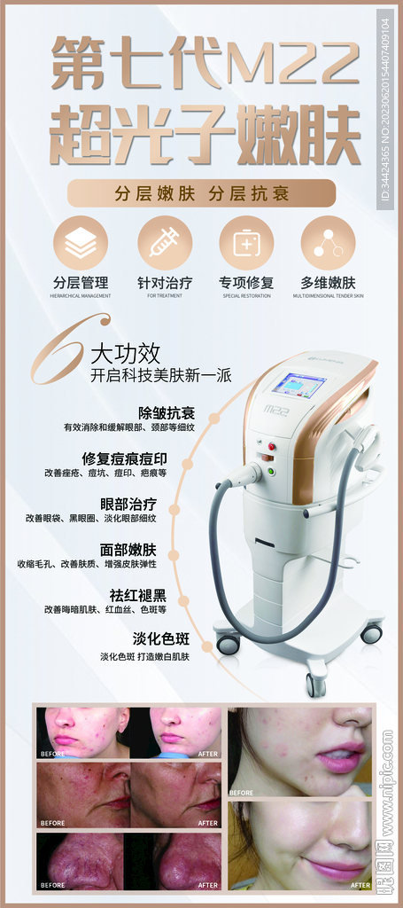 超光子嫩膚