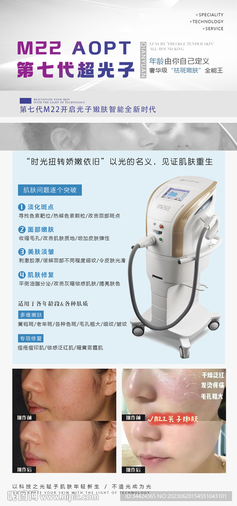 超光子嫩膚