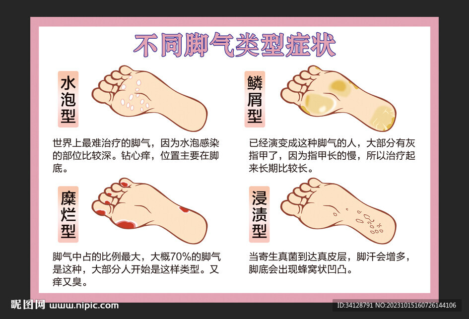 腳氣類型