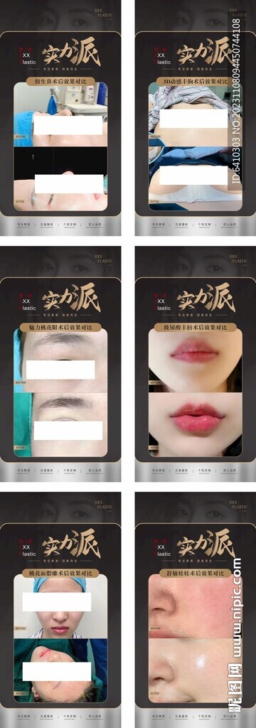 醫美整形案例對比圖