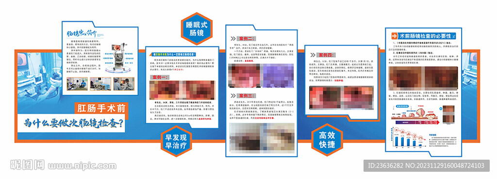 腸鏡