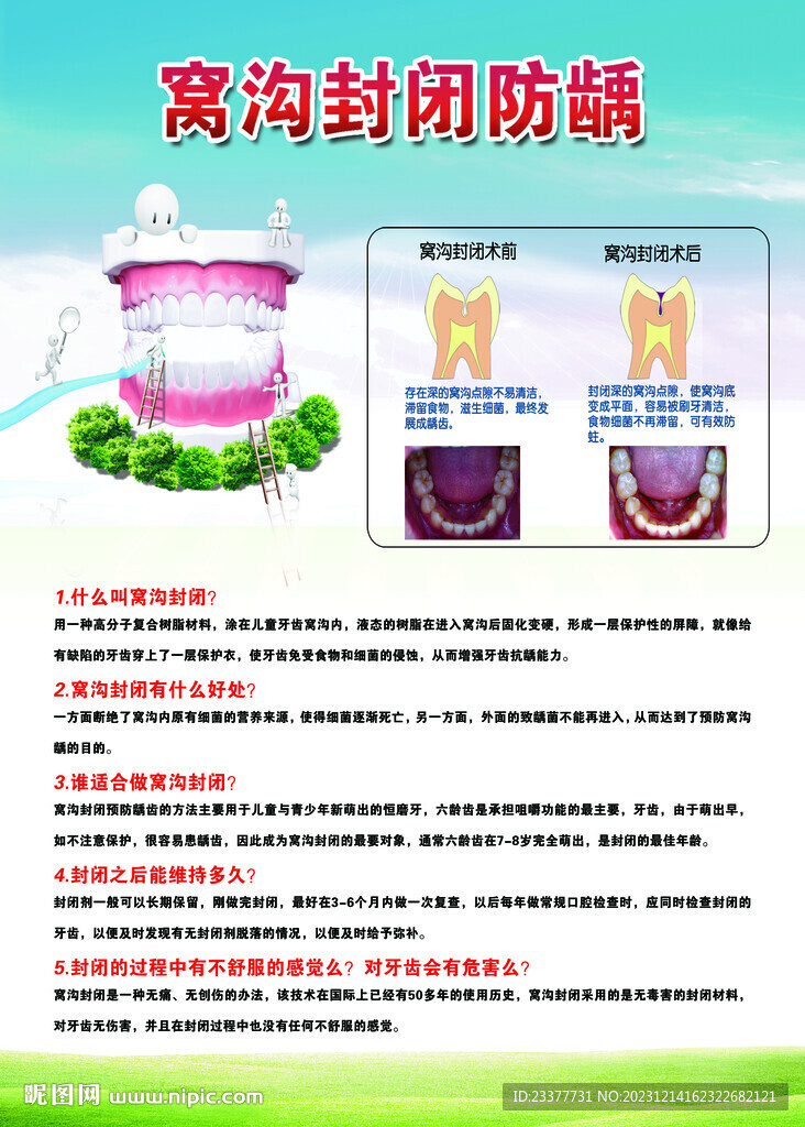 窩溝封閉傳單