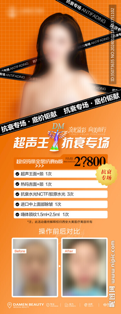 醫美整形 超聲王 項目 