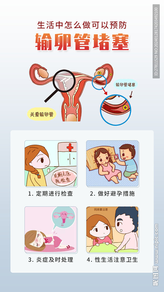 生活中如何預(yù)防輸卵管堵塞