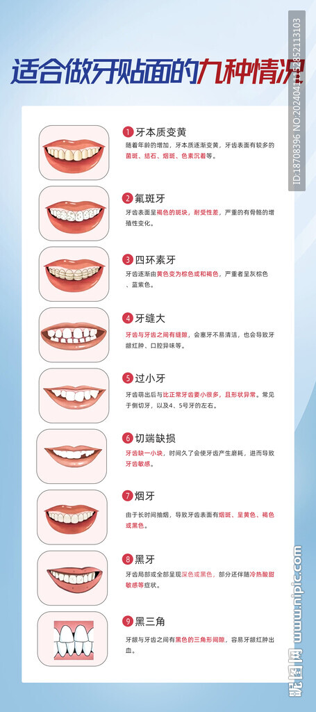 口腔科普牙貼面
