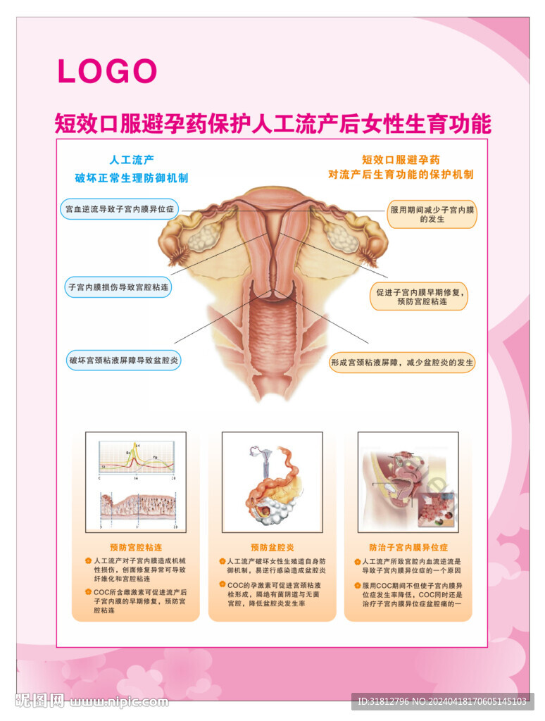 口服避孕藥保護(hù)人工流產(chǎn)后女性生