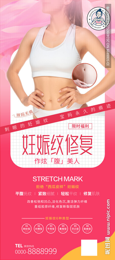 妊娠紋 展架