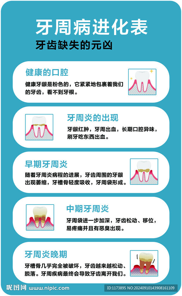 牙周病進(jìn)化表