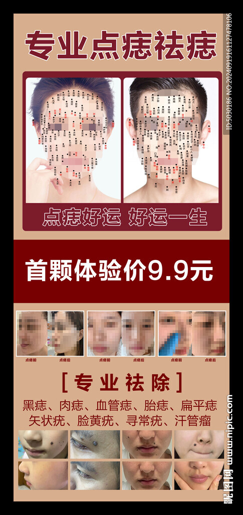 點痣展架