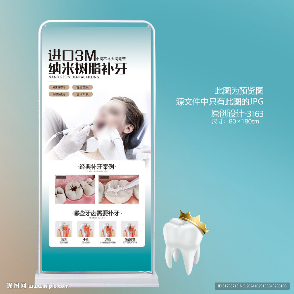牙科口腔醫(yī)院補(bǔ)牙種植牙展架