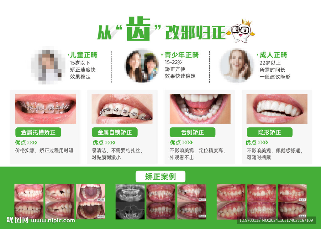 口腔牙齒矯正