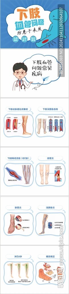 靜脈曲張常見疾病