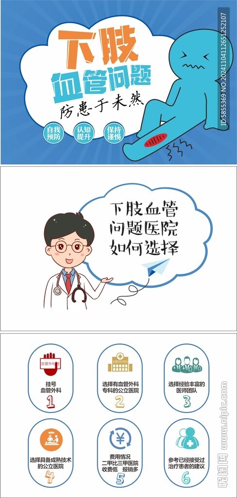 靜脈曲張科普