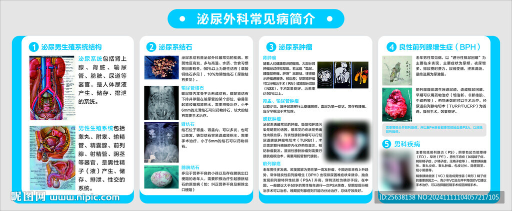 泌尿外科常見疾病