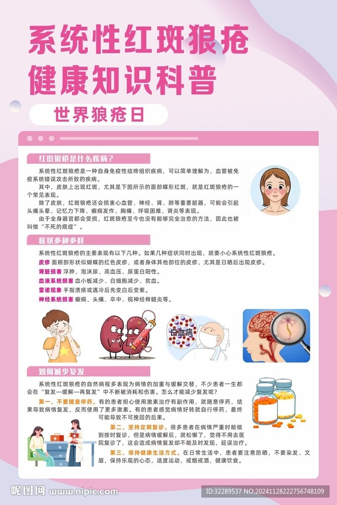 系統(tǒng)性紅斑狼瘡知識(shí)科普