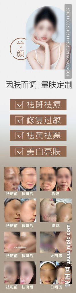 祛斑海報(bào)