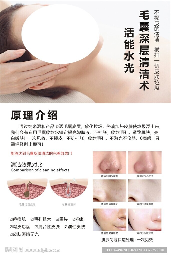 毛囊深層清潔