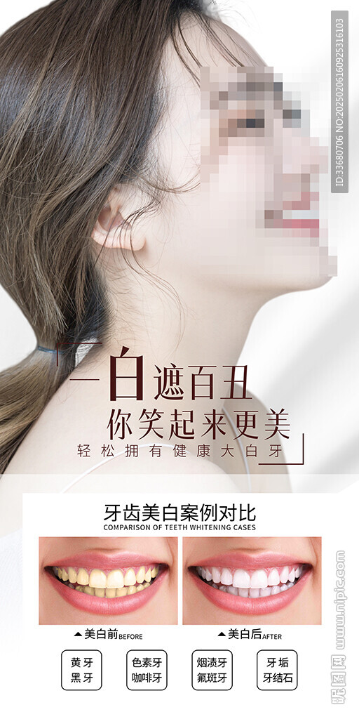 口腔醫院廣告圖片海報美女牙齒