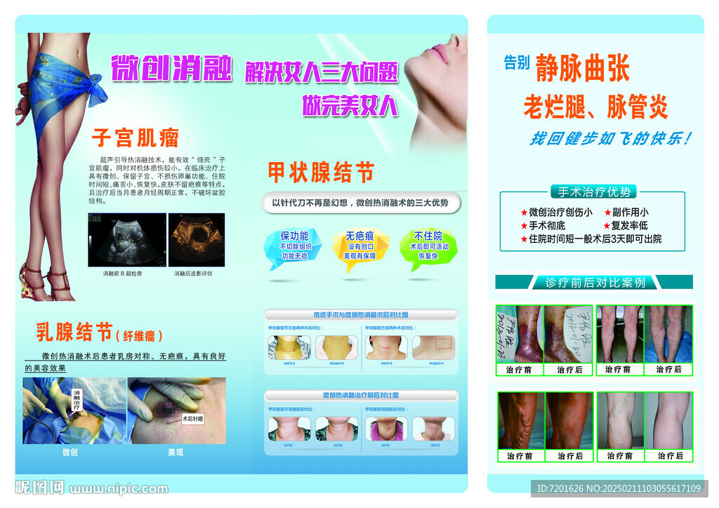 微創消融