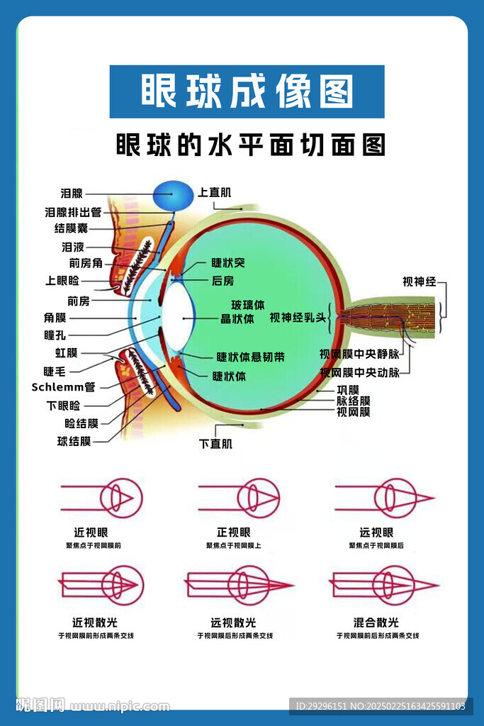 眼球成像圖