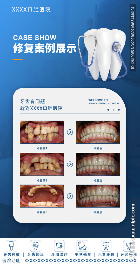 牙齒修復案例海報