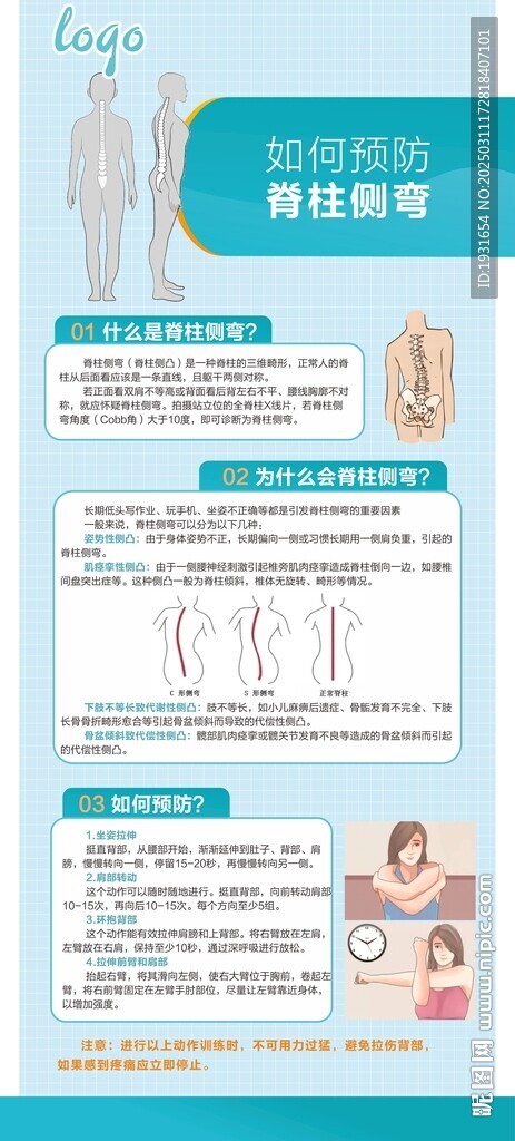 預防脊柱側彎