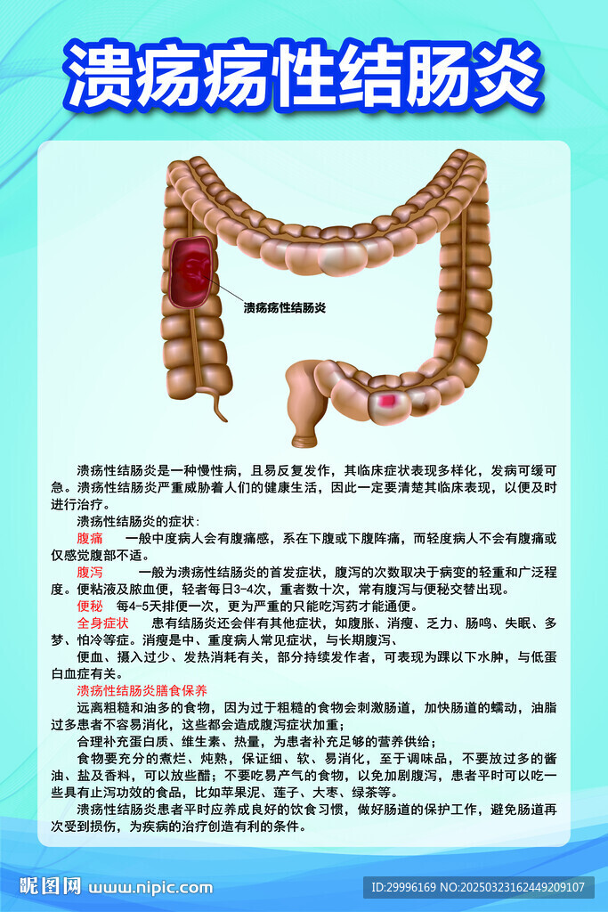 潰瘍性結(jié)腸炎
