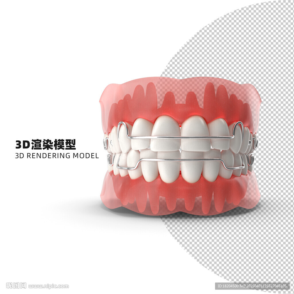 口腔矯正3D渲染模型