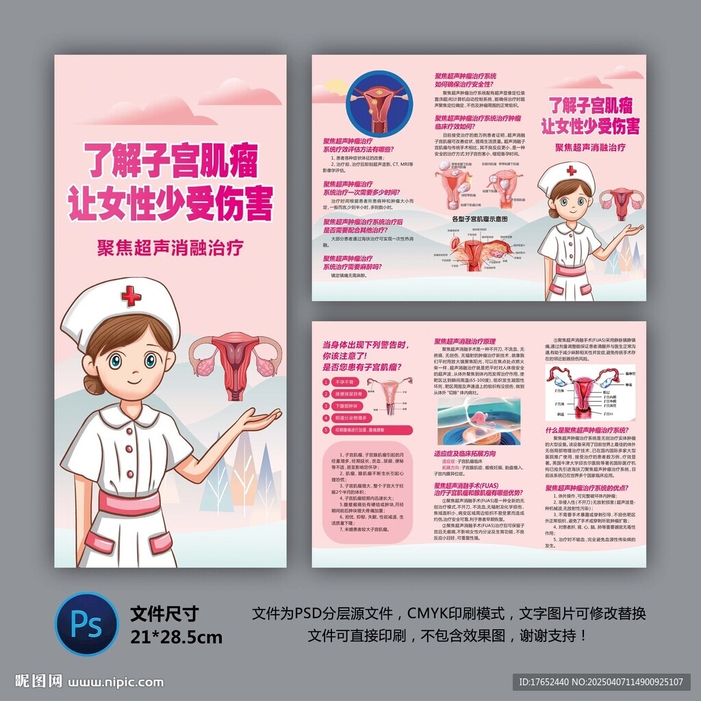 子宮肌瘤的治療