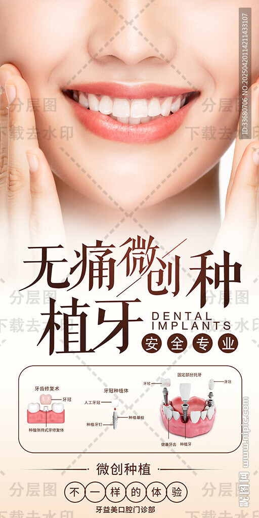 口腔科海報(bào)口腔微笑圖無(wú)痛種植牙