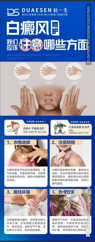 白癜風