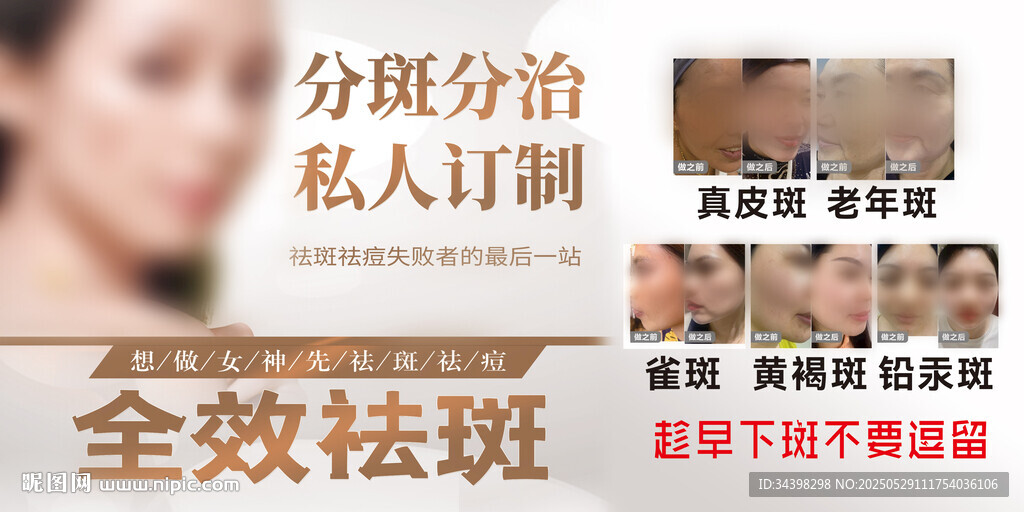 祛斑海報(bào)