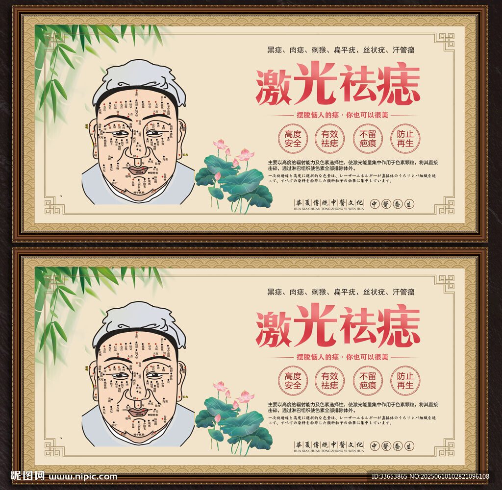 祛痣