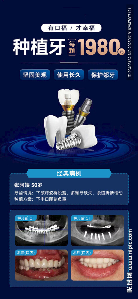 口腔種植牙案例海報