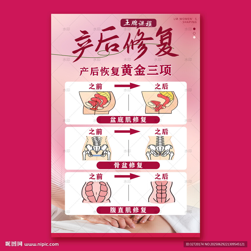 產(chǎn)后修復(fù)