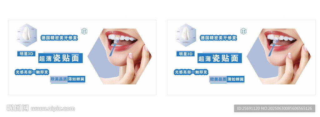 牙齒瓷貼面