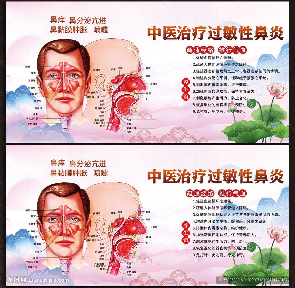 鼻炎展板