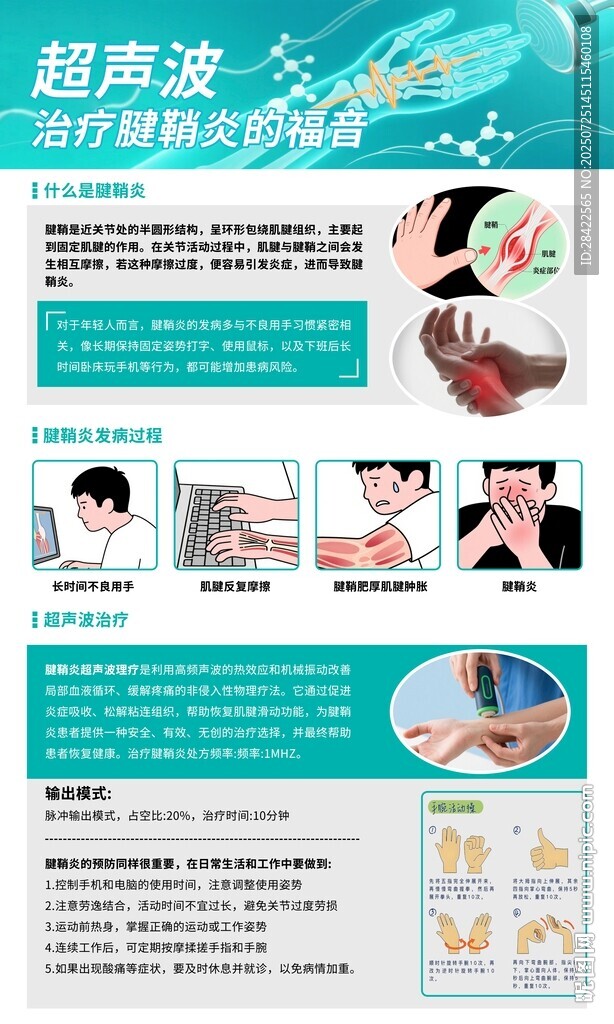 腱鞘炎海報(bào)