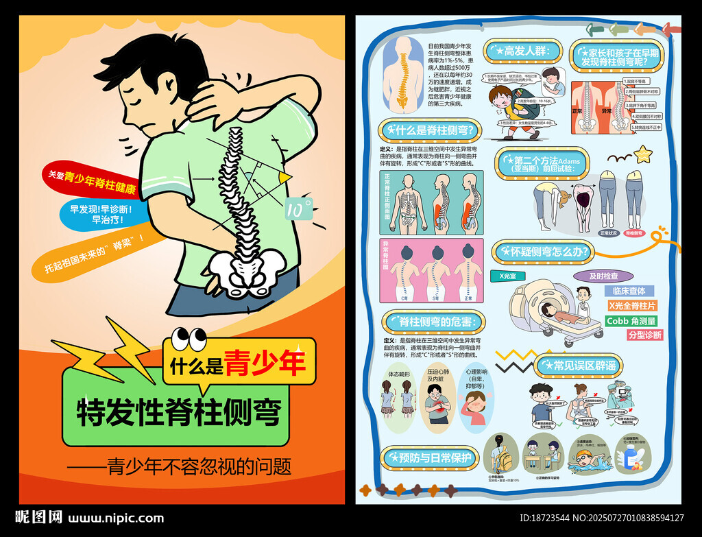 脊柱側彎
