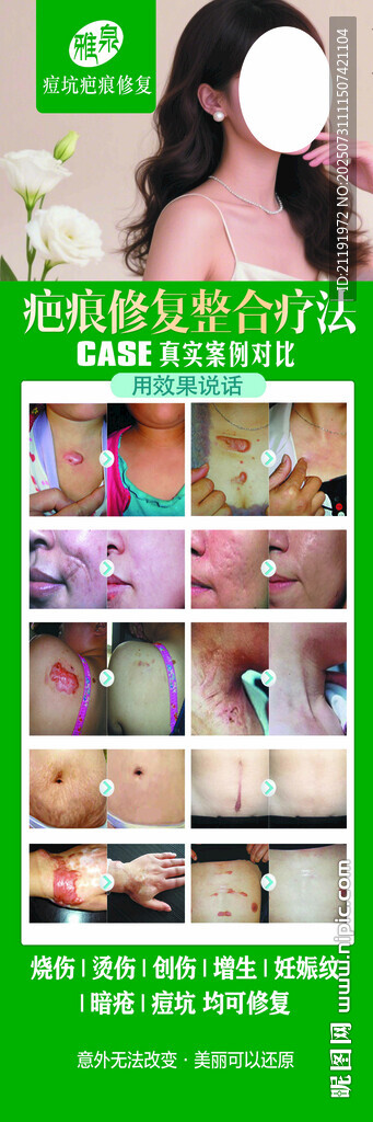 疤痕修復(fù)美容海報祛疤展架