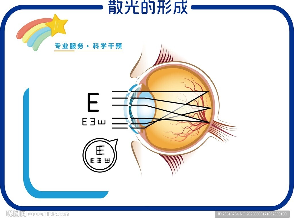 散光的形成