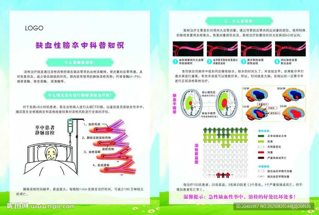 缺血性腦卒中